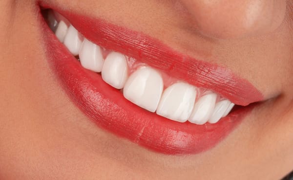 Female showing her teeth representing Align Technology in a stock rallies after earnings beat as broader market declines